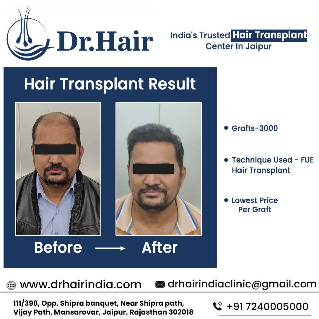 Before & After - Case 2