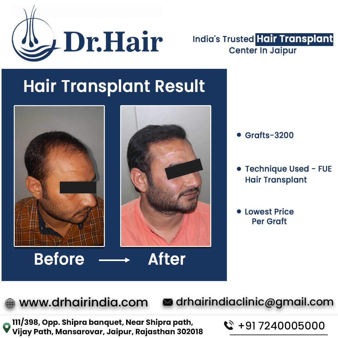 Before & After - Case 3