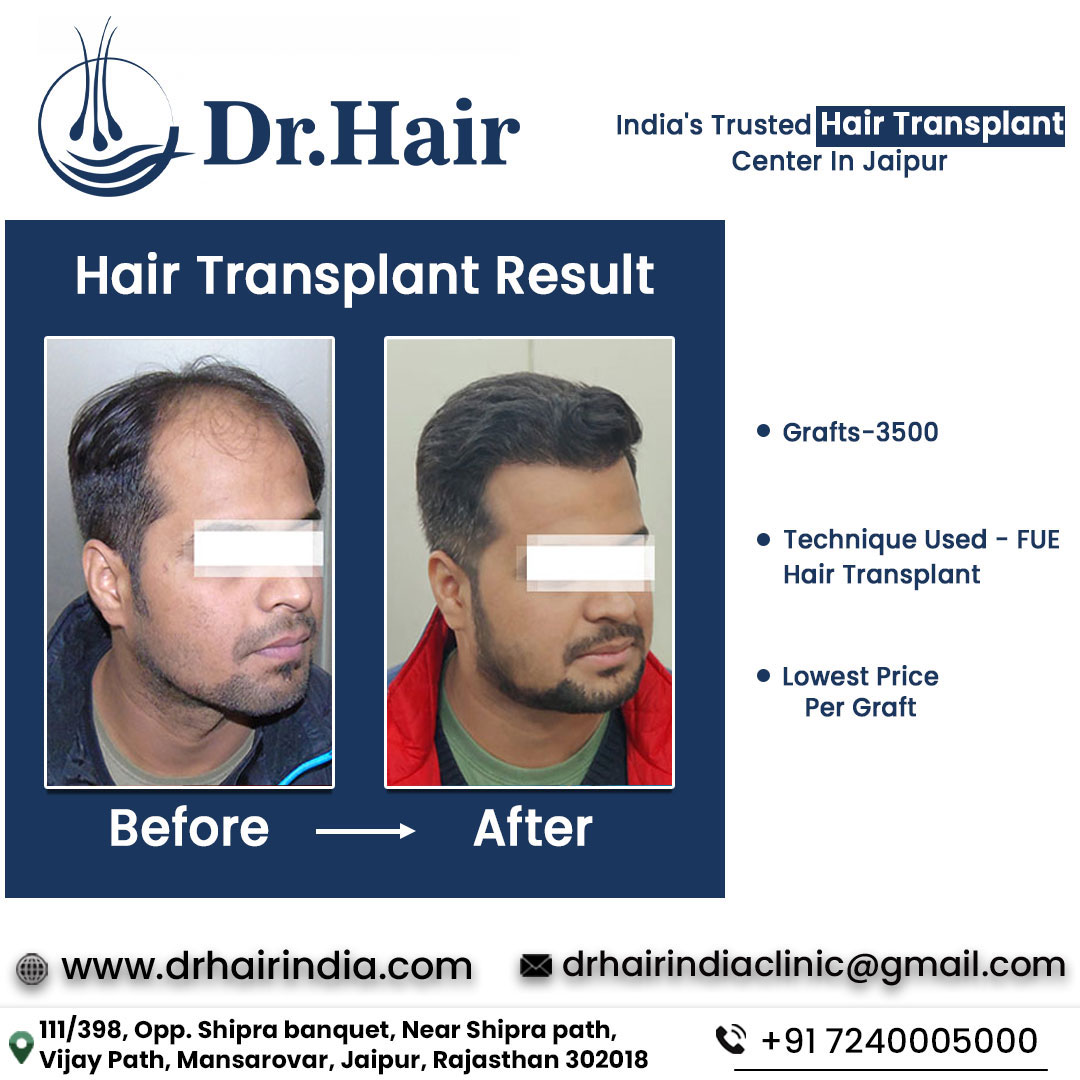 Before & After - Case 4