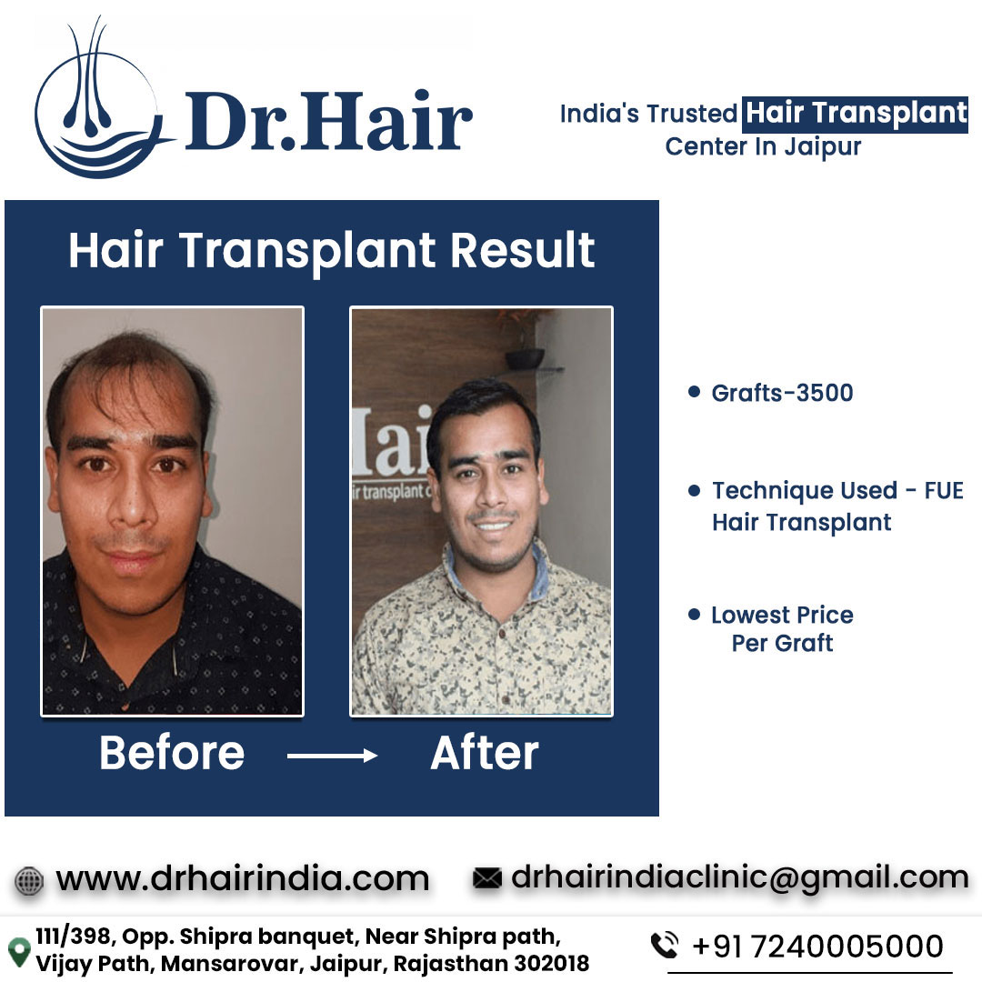 Before & After - Case 5